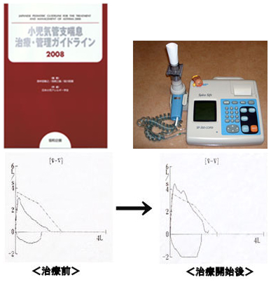 小児気管支喘息