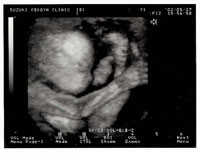 検診時に3Dエコーも録画できます。